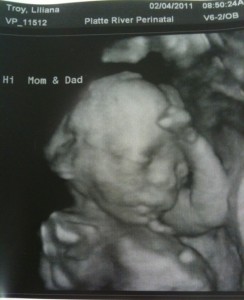 Raistlin 3D ultrasound 20 weeks